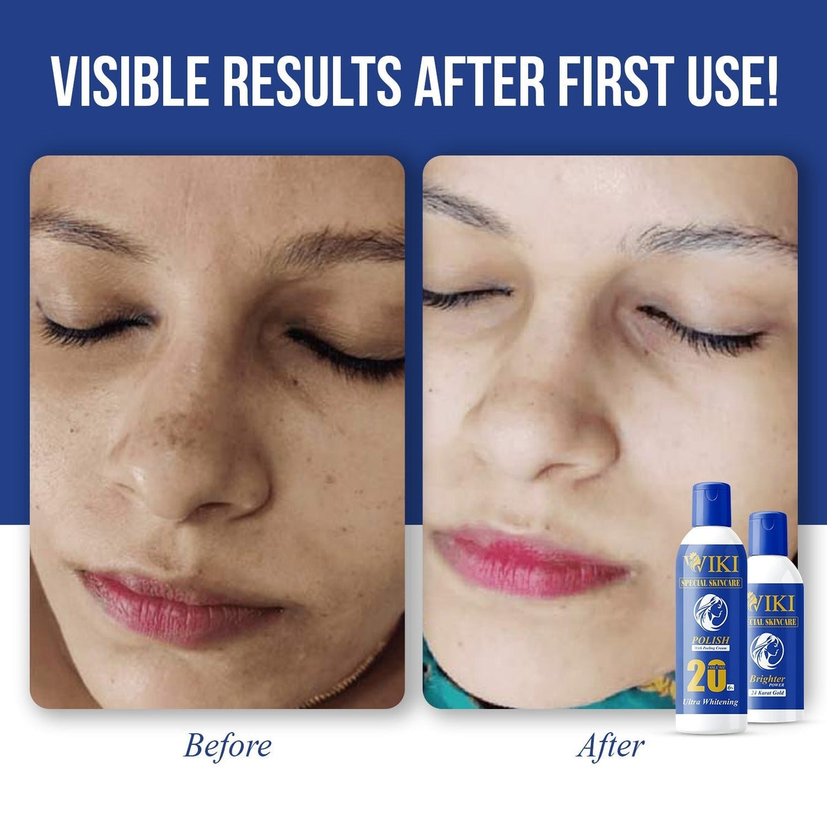 Wiki Skin Polish