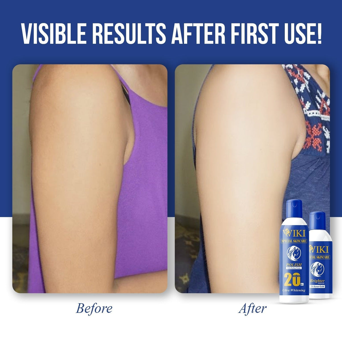 Wiki Skin Polish